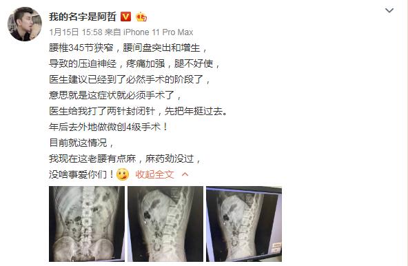 YY阿哲汇报手术进程称头大